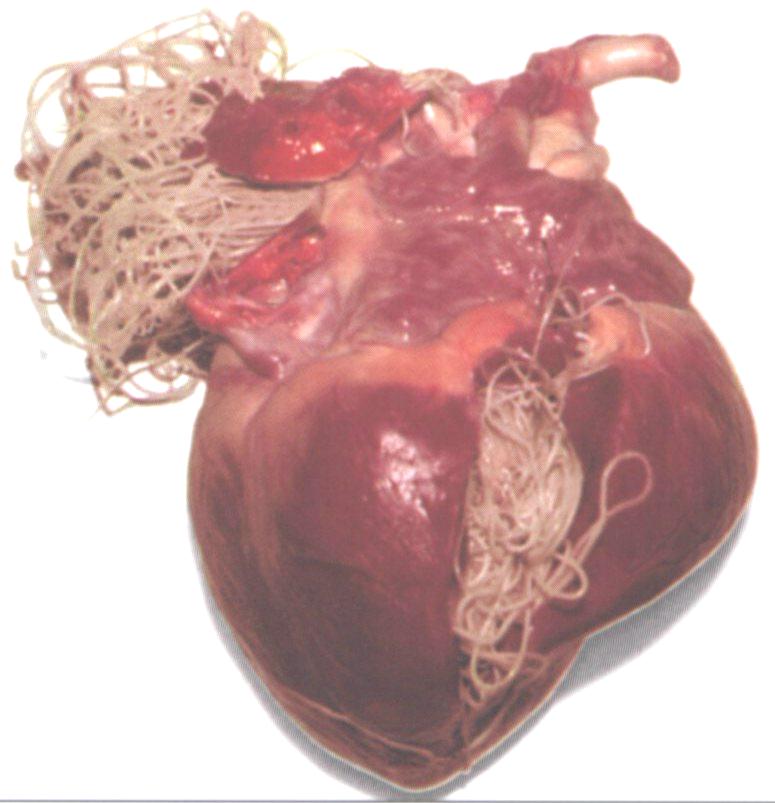 heart parasite PARAZITII provoaca cancer si alte boli grave