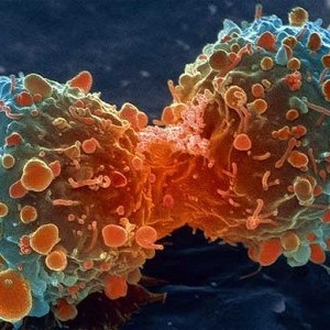 Celulele canceroase