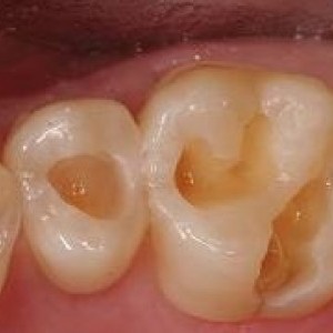 afectiunile buco-dento-maxilare